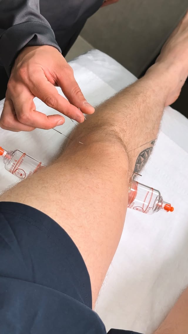 Equilíbrio emocional com acupuntura clínica
